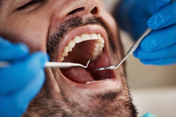 Best Broken or Cracked Tooth Emergency Dentist in Euharlee, GA
